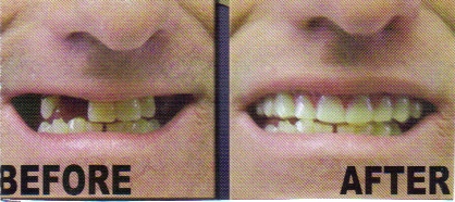 cosmoteeth_bef-and-aft_1.jpg